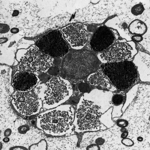 Aplysina cavernicola spherulous cell by Alexander Ereskovsky